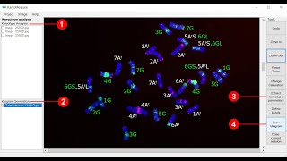 Karyotype analysis using KaryoMeasure [upl. by Annelise]