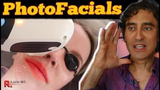 PHOTOFACIAL  HOW MANY IPL TREATMENTS [upl. by Trainer517]