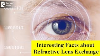 What is RLE Refractive Lens Exchange  Dr Sriram Ramalingam [upl. by Barayon235]