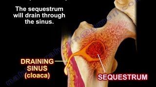 The Role and Anatomy of the Pancreas [upl. by Mackoff]