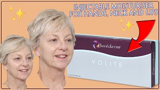 Juvederm Volite The Injectable Moisturiser Treatment for Hands Neck and Lips [upl. by Allit68]