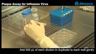 Plaque Assay for Influenza Virus [upl. by Thalia]