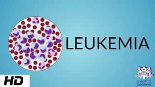 LEUKEMIA Causes Signs and Symptoms Diagnosis and Treatment [upl. by Maximilien493]