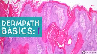 Basic Dermpath Cases  Explained by a Dermatopathologist [upl. by Aim]