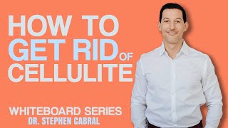 21 Days to REMOVE CELLULITE  Do These 3 Things for QUICK Results  Dr Stephen Cabral [upl. by Joh]