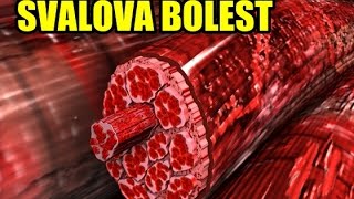 SVALOVÁ BOLEST  Mám jít cvičit když sval ještě bolí [upl. by Aiset]