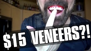 Perfect Smile Veneers Review 15 Veneers [upl. by Norrat152]