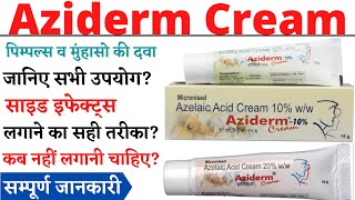 Aziderm Cream Aziderm 10 Cream Aziderm 20 Cream Review in Hindi [upl. by Preston147]