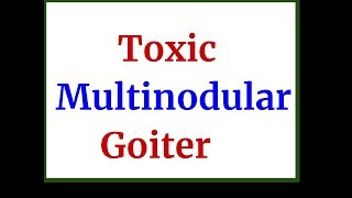 Toxic Multinodular Goiter [upl. by Chader]