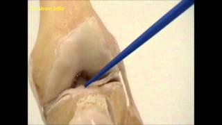 Anatomy of the knee joint [upl. by Ermanno929]