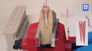 Endodontic treatment of the single rooted tooth Part 6 Obturation [upl. by Llenral58]