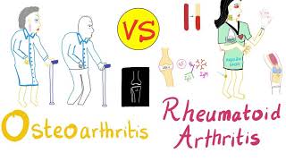 Overview of Rheumatoid arthritis and treatment  Pharmacology [upl. by Stefano]