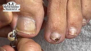 Mr Meticulous Deep Sidewall Cleaning Ingrown Prevention [upl. by Roy]