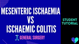 Mesenteric Ischaemia vs Ischaemic Colitis  Medical Tutorial [upl. by Hessler]