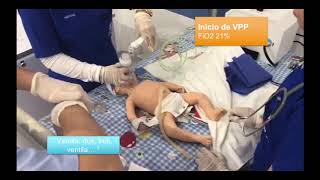 REANIMACION NEONATAL ALGORITMO COMPLETO [upl. by Chloris]