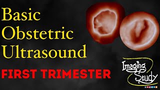 Basic Obstetric Ultrasound First Trimester Pregnancy [upl. by Ebeohp96]