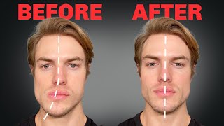 How to Fix Asymmetrical Jaw amp Face FOREVER [upl. by Ynohtnakram]