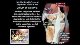 Medial Patellofemoral Ligament Of The Knee Anatomy Everything You Need To Know  Dr Nabil Ebraheim [upl. by Erodasi342]