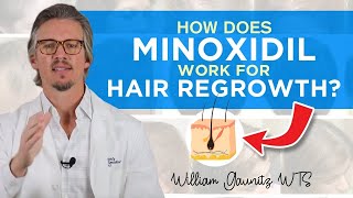 Minoxidil How Does Minoxidil Work For Hair Regrowth Results  Trichologist William Gaunitz [upl. by Dami267]