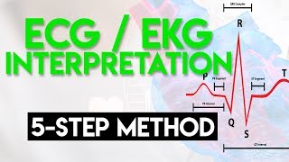 The ECG Course  Intervals amp Segments [upl. by Donnell]