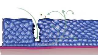 Natural History of HPV Infection [upl. by Colyer]