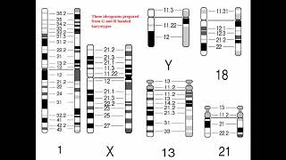 Cytogenetics II Chromosome Analysis amp Karyotypes [upl. by Sito]