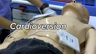 Cardioversion  Defibrillation Technique [upl. by Itoc]