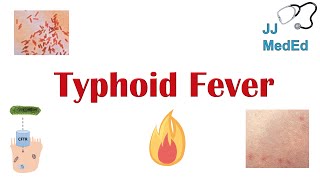 Typhoid Fever Pathogenesis vectors bacteria Symptoms Diagnosis Treatment Vaccine [upl. by Anelet]