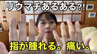 【リウマチ患者】指の関節が腫れる。痛い。関節リウマチ 指の痛み テーピング [upl. by Ronnica]