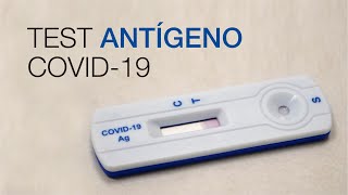 Test Antígeno COVID19 Clínica CEMTRO [upl. by Rosemarie605]