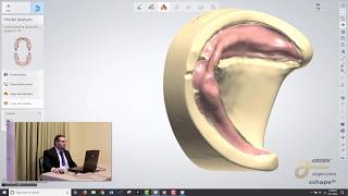 Digital Dentures A Crash Course on How to Design using 3Shape  Logan Woomer [upl. by Hen]