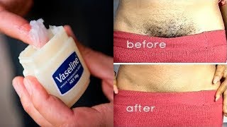 Remove Unwanted Hair In 2 Minutes With Vaseline [upl. by Jenelle85]