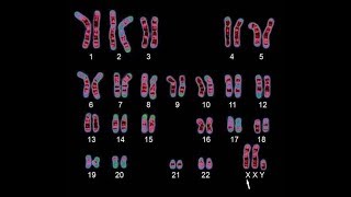 Human Genetics  Karyotyping [upl. by Mcallister770]