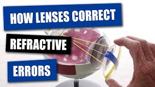 How Opticians Use Lenses To Correct Refractive Errors [upl. by Gaelan]