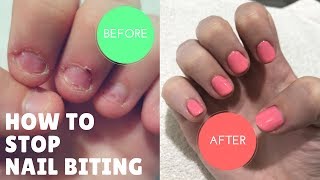 HOW I STOPPED BITING MY NAILS AFTER 20 YEARS [upl. by Amaris]