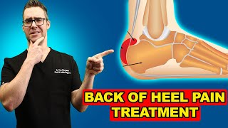 Retrocalcaneal Heel BURSITIS Treatment Heel Pain Exercises amp Massage [upl. by Atahs]