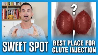 Best Place For Glute Injection  The Sweet Spot [upl. by Luo]