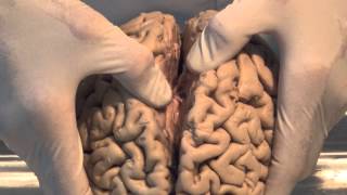 Introduction Neuroanatomy Video Lab  Brain Dissections [upl. by Esac]