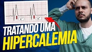 Como tratar uma hipercalemia [upl. by Erual]