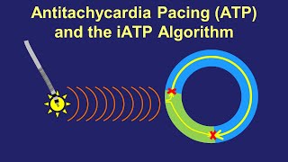 Pacing Guide What is it [upl. by Aisad134]