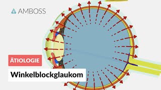 Akutes Winkelblockglaukom bei Pupillarblock  AMBOSS Video [upl. by Neysa]