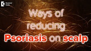 What helps psoriasis on scalp  Dr Rasya Dixit [upl. by Clemmy]