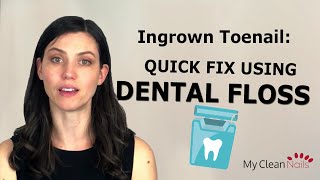 Ingrown Toenail A Quick Fix With Dental Floss [upl. by Hoj]