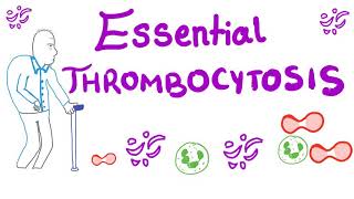 Essential Thrombocytosis ET  Myeloproliferative Neoplasm JAK2 Kinase [upl. by Wehtam553]