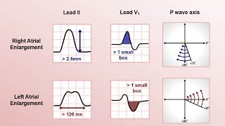 ECGs  How they work [upl. by Mathi]