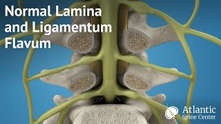 Normal Lamina and Ligamentum Flavum [upl. by Dorthy]