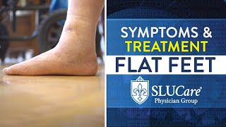 Flat Feet Symptoms Causes amp Treatment Options  SLUCare Orthopedic Surgery [upl. by Lora]