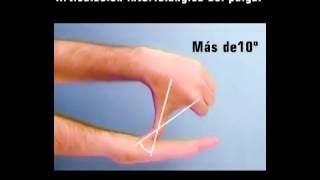 Columna del pulgar 4  Articulación interfalángica [upl. by Dibrin]