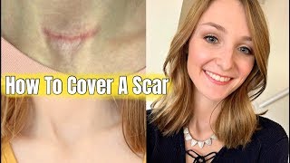 How To Cover A Scar or Surgical Incision [upl. by Lilian298]