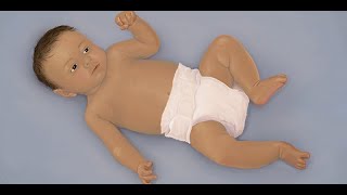 Head Bobbing Respiratory Distress in infants [upl. by Leland714]